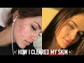 MY SKINCARE ROUTINE! (HOW I CLEARED MY ACNE) | Mel Joy